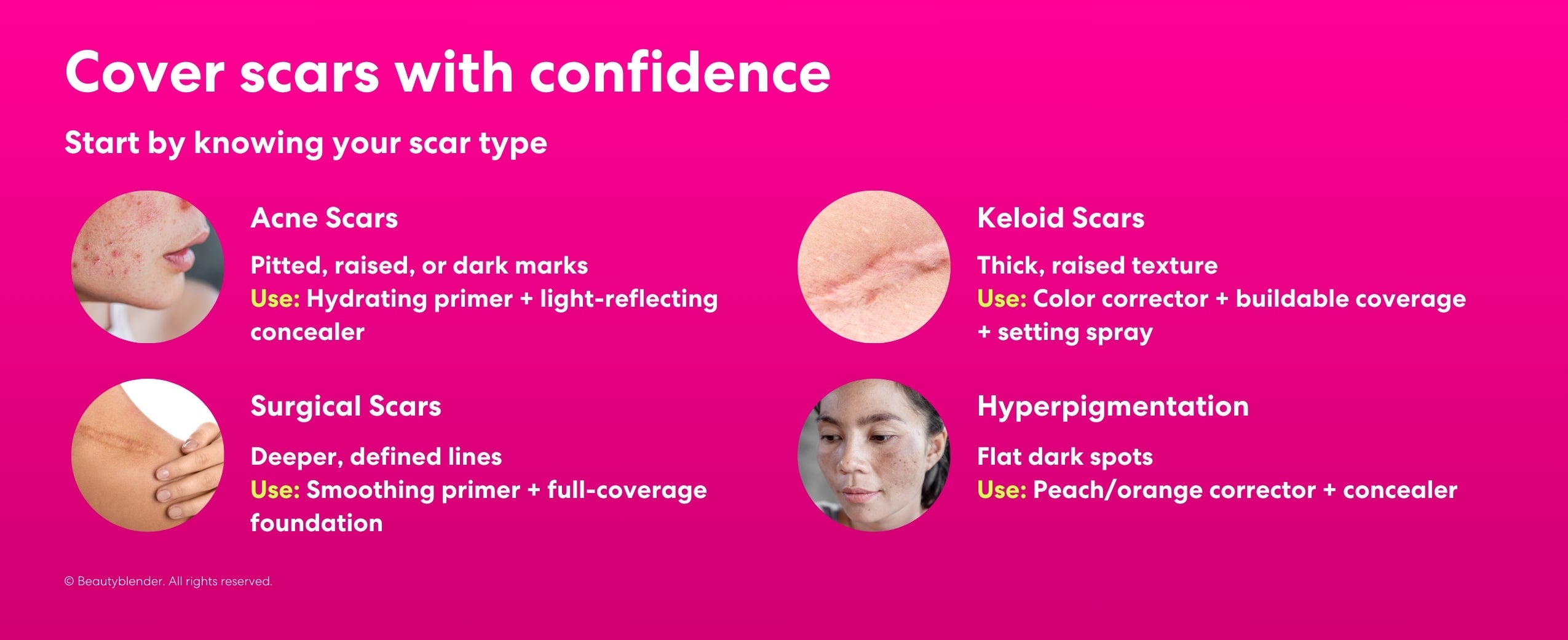 Cover scars with confidence