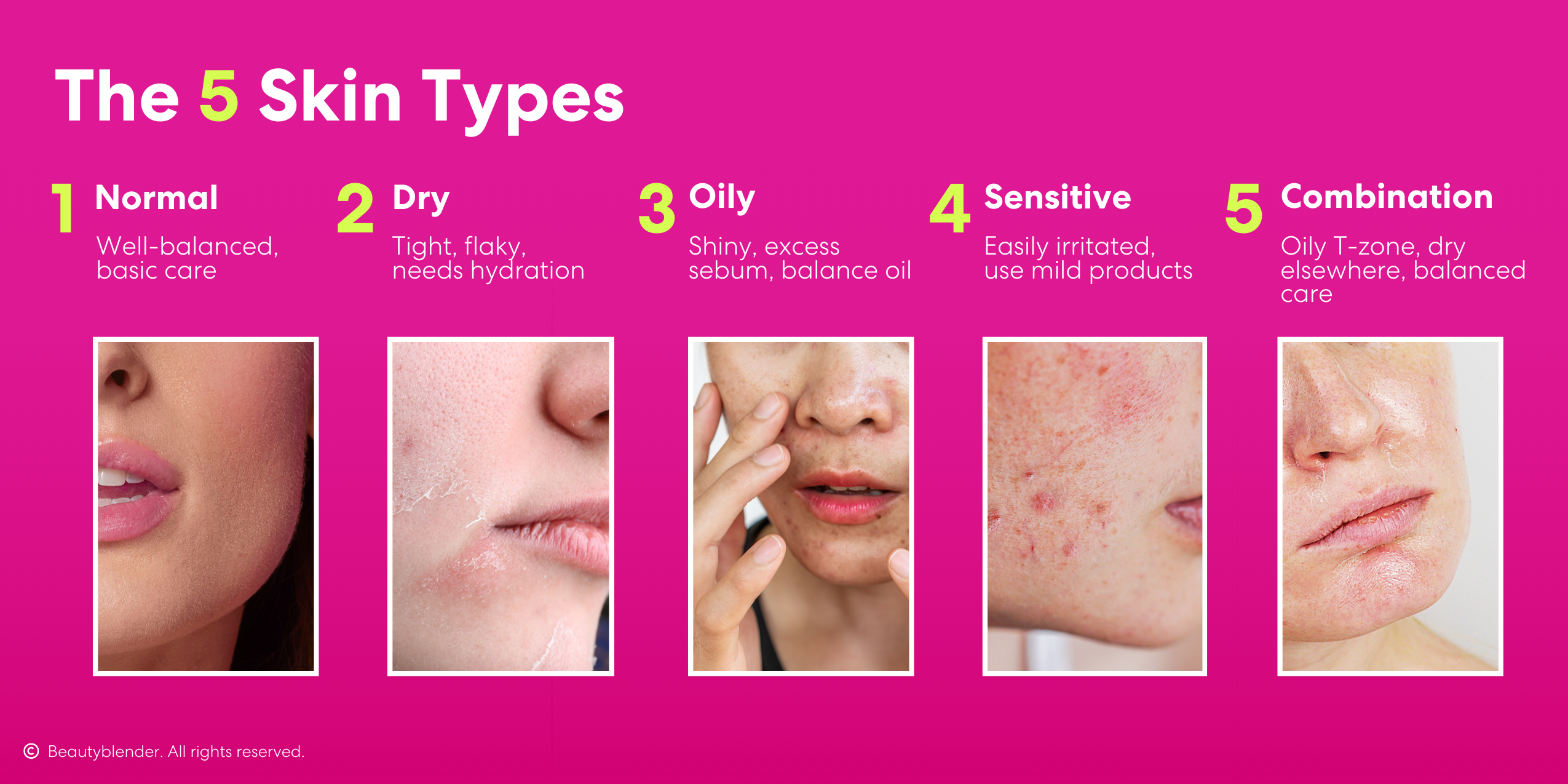 What are the 5 Skin Types